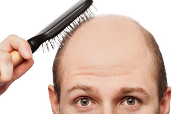 Reverse balding by transplantation