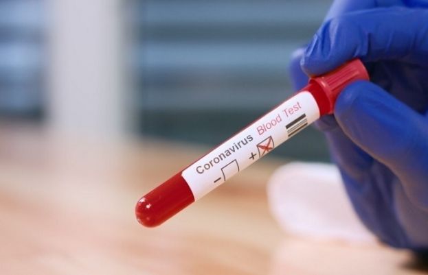 کووڈ 19 کی شرح میں لاک ڈاؤنز اور ویکسینیشن کے نتیجے میں کمی آنے کے باوجود رواں سال اس کا خاتمہ ممکن نظر نہیں آتا۔