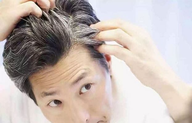 بالوں کی سفیدی