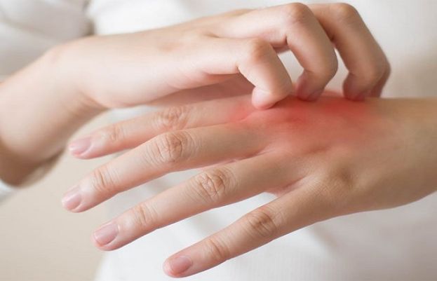 جلد کا پیلا پن خون کی کمی کی علامت ظاہر کرتا ہے