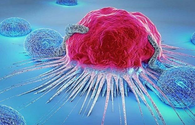 بریسٹ کینسر