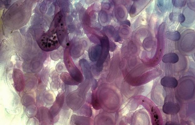 پیٹ کے کیڑوں سے کینسر کے خلاف جنگ میں پیشرفت