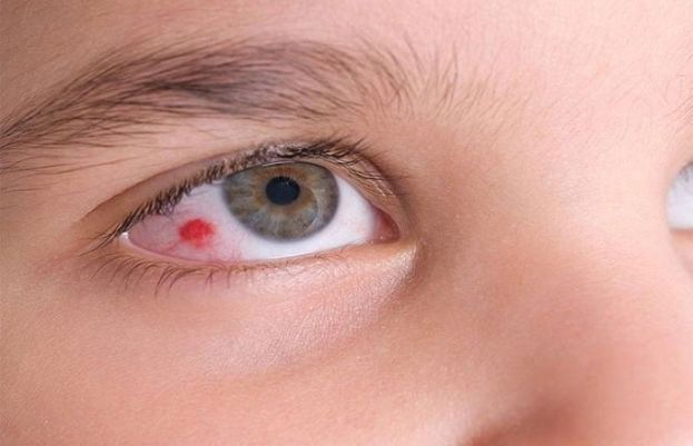 شوگر میں مبتلا افراد کے آنکھوں کے زخم دیر سے کیوں بھرتے ہیں؟